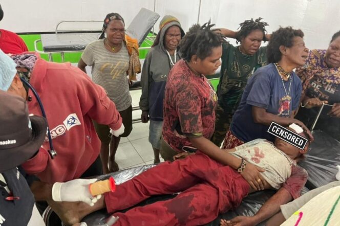 
					Serang anak korban serangan KKB di Kabupaten Intan Jaya, Papua Tengah. (Dok Satgas Damai Cartenz 2024)